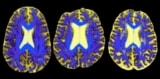 Axial DSEG images