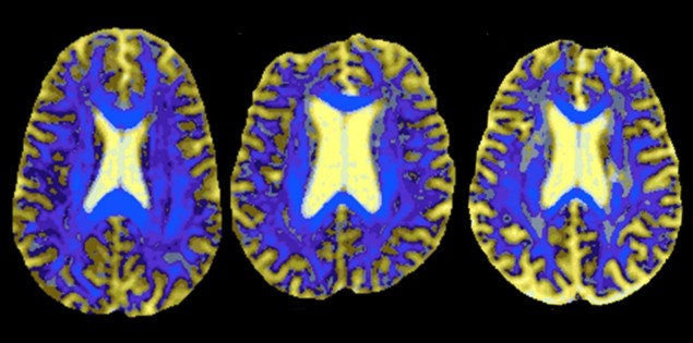 Axial DSEG images Axial DSEG images