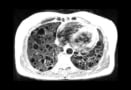 Low-field MRI