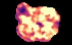 MR elastography