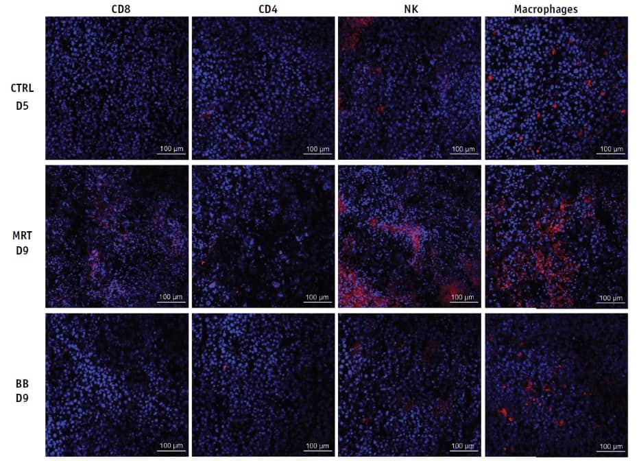 Immune cell infiltration