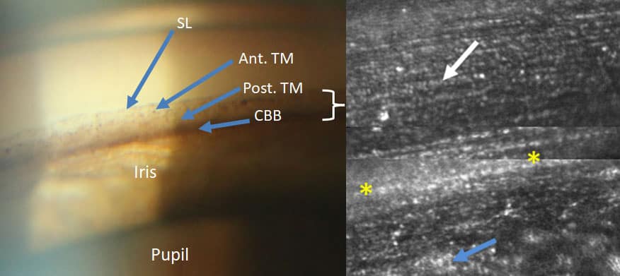 The trabecular meshwork