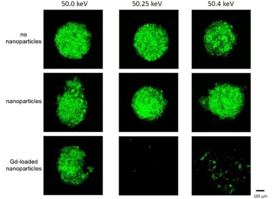 Gd-loaded nanoparticles plus monochromatic X-rays can destroy tumours ...