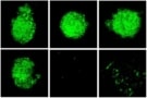 Energy dependence of tumour spheroid destruction.