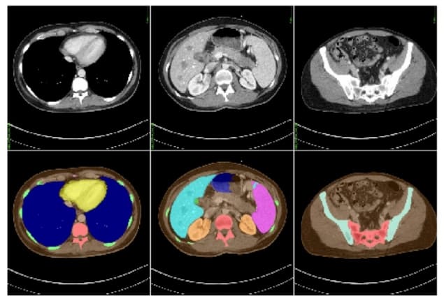 CT dataset