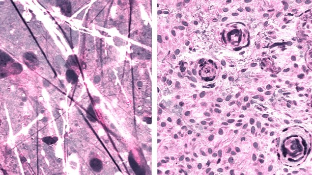 Stimulated Raman histology