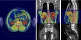 Machine Learning for Tomographic Imaging