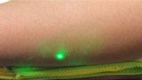Laser ultrasound