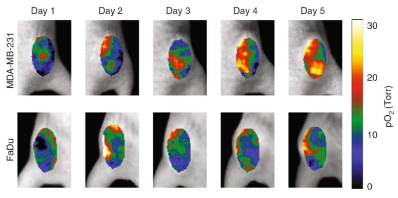 Tumour hypoxia tracked in real time during radiotherapy – Physics World