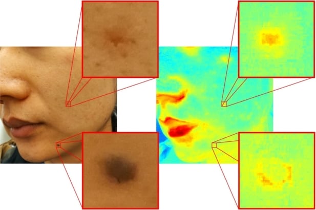 Smartphone camera enables hyperspectral imaging for skin analysis ...