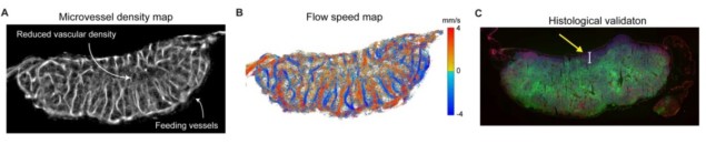 Super-resolution imaging