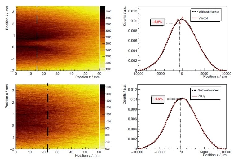 How do fiducial markers affect particle therapy dose distributions