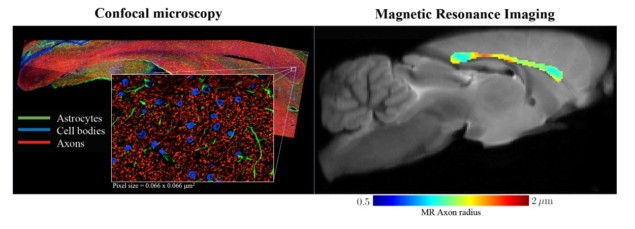 Confocal microscopy and dMRI