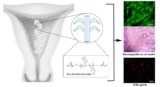 Contraceptive hydrogel