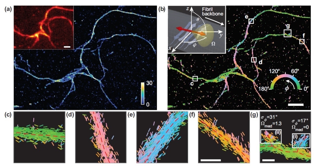 Super-resolution microscopy reveals nanoscale details of amyloid ...