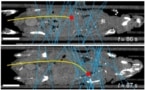 Cell tracking