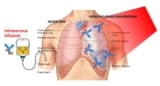 Targeted phototherapy