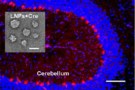 Drug delivery into the brain