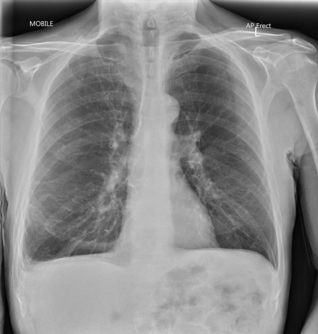 Standing on the outside looking in Xrays through glass Physics World