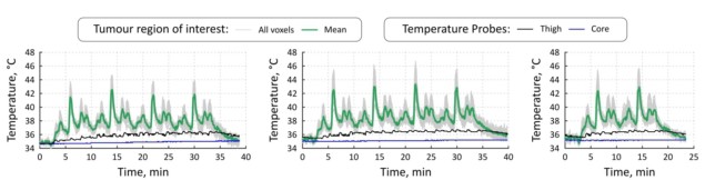 Temperature profiles