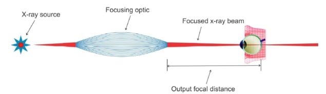 Treatment schematic