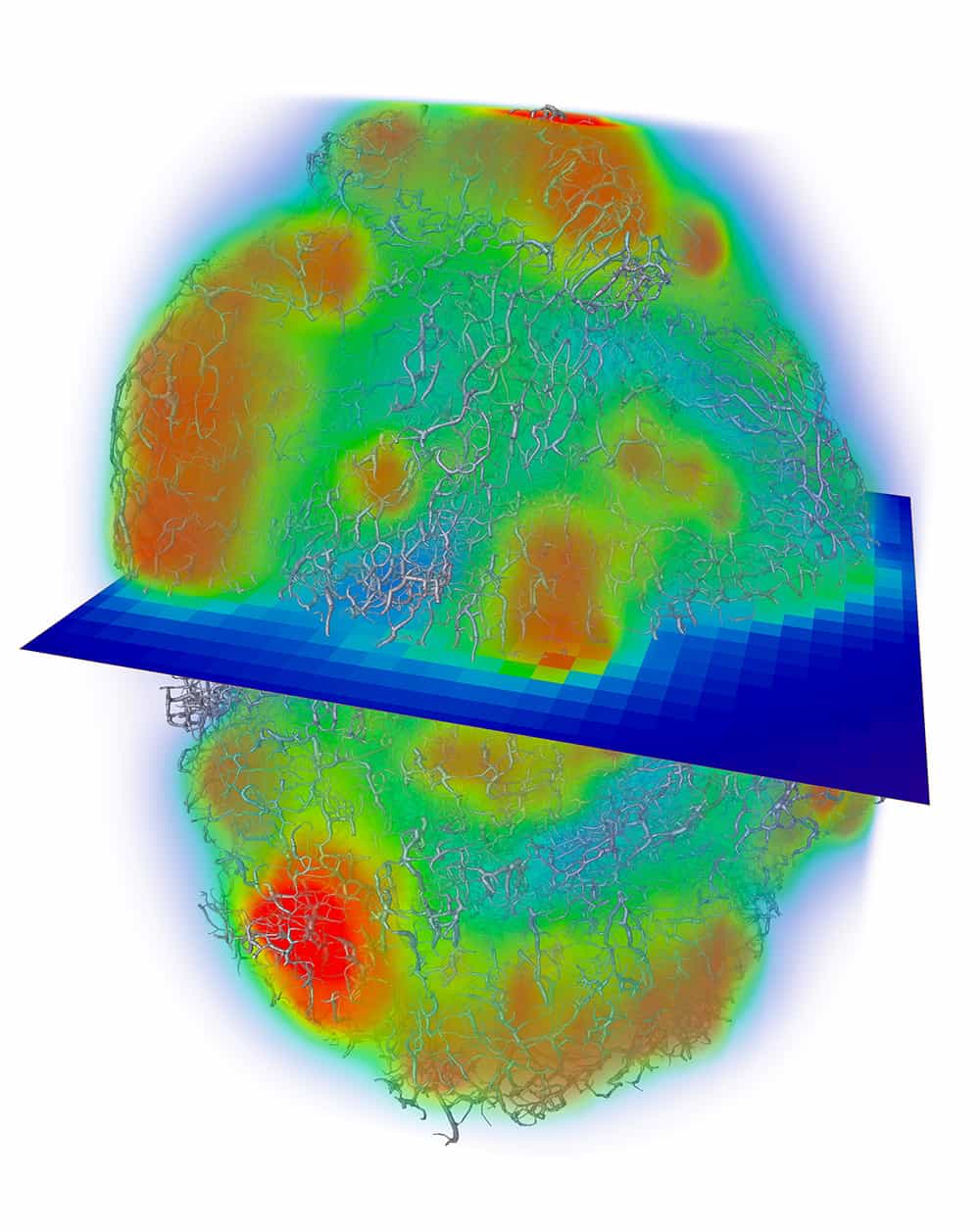 Modelling blood The tumour models that Paul Sweeney builds at the University of Cambridge use well-established mathematical models, such as those for microcirculatory blood flow (image at top of article), in combination with new approaches for predicting fluid distribution through the interstitial tissue (above). Both models are parameterized and validated against biomedical imaging data. (Courtesy: Paul Sweeney)