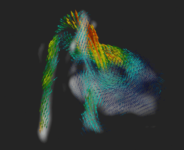 4D MRI
