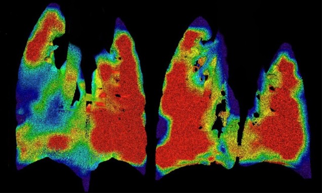 Mapping lung function