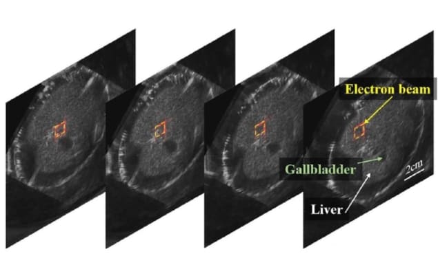 FLASH dosimetry