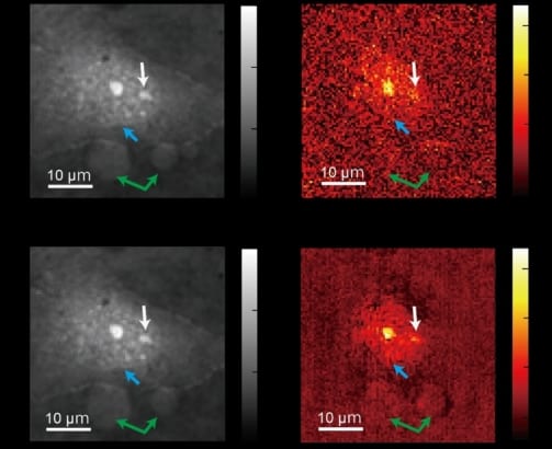 Intelligent microscope uses AI to capture rare biological events ...