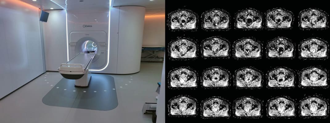 Quantitative MRI for biological image-guided adaptive radiotherapy ...