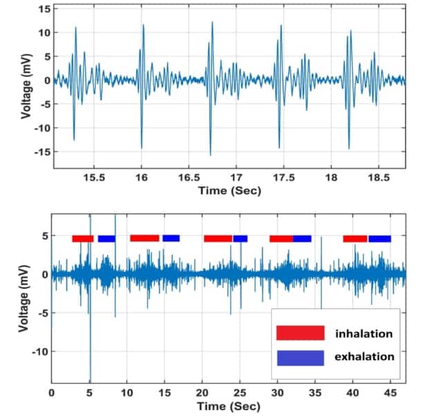 Heart and lung signals