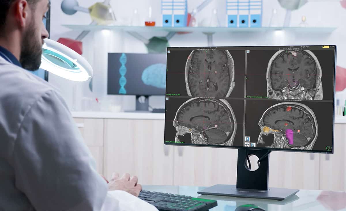 Image: Inverse planning with Leksell Gamma Knife Lightning: Clinical plan quality and efficiency