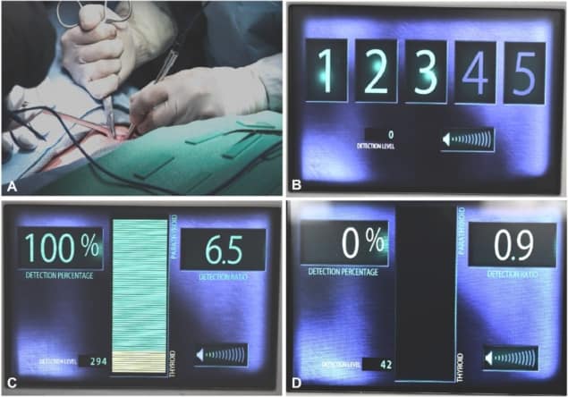 Identifying parathyroid tissue Identifying parathyroid tissue