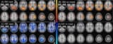 Brain activity maps