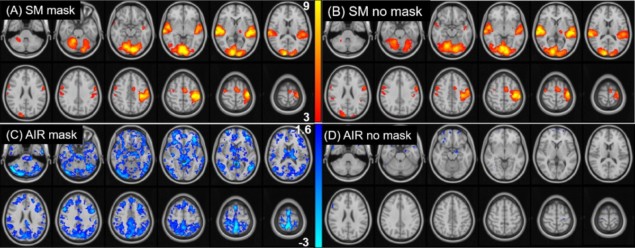 Brain activity maps