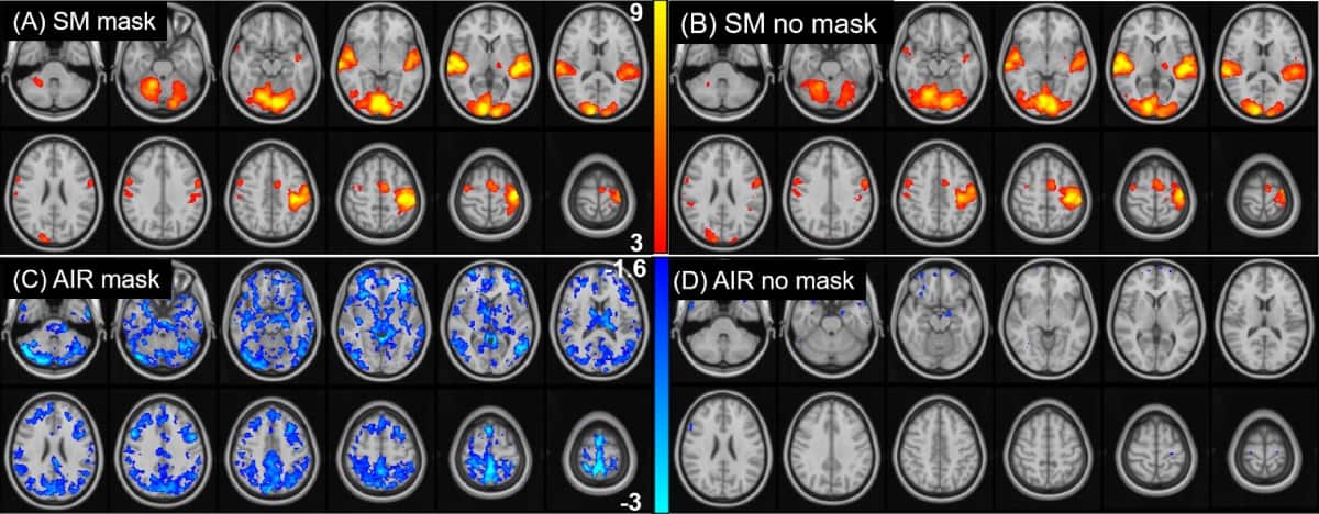 Image: How do surgical face masks affect functional MRI measurements?