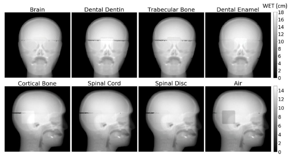 Proton radiography one step closer to clinical use Physics World