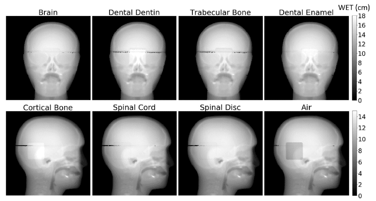 Proton radiographs