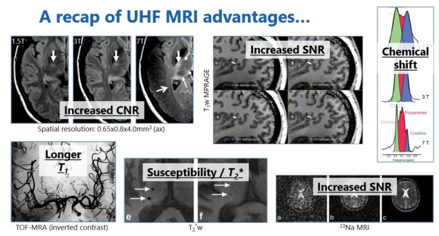Ultrahigh-field MRI advantages