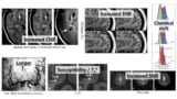 Ultrahigh-field MRI advantages