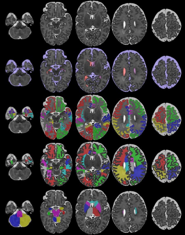 MRI scans taken as part of the Developing Human Connectome Project