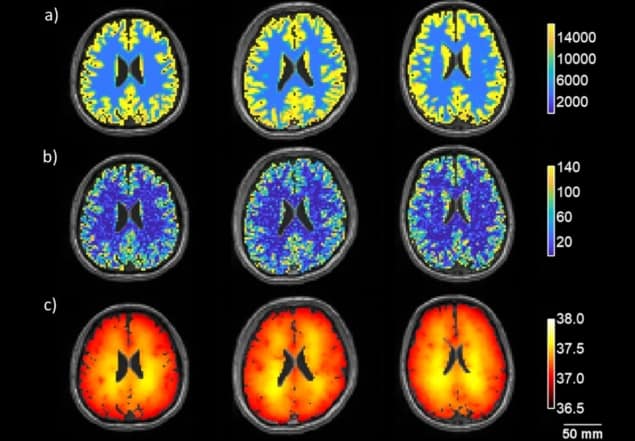 Mapping brain temperature
