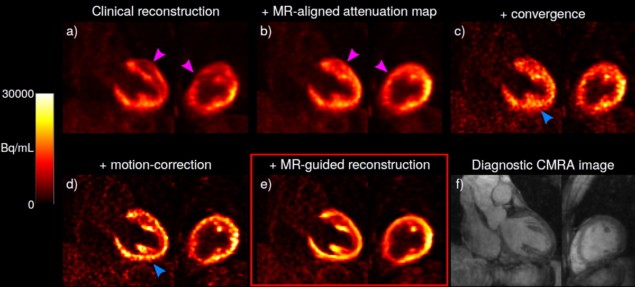 PET image reconstruction