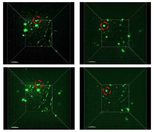 Two-photon microscopy of amyloid plaques