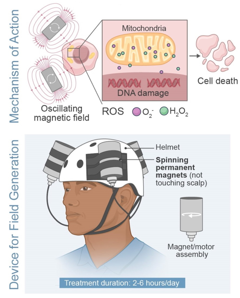 Head-mounted magnetic device shrinks brain tumour – Physics World