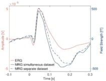 ERG and MRG signals
