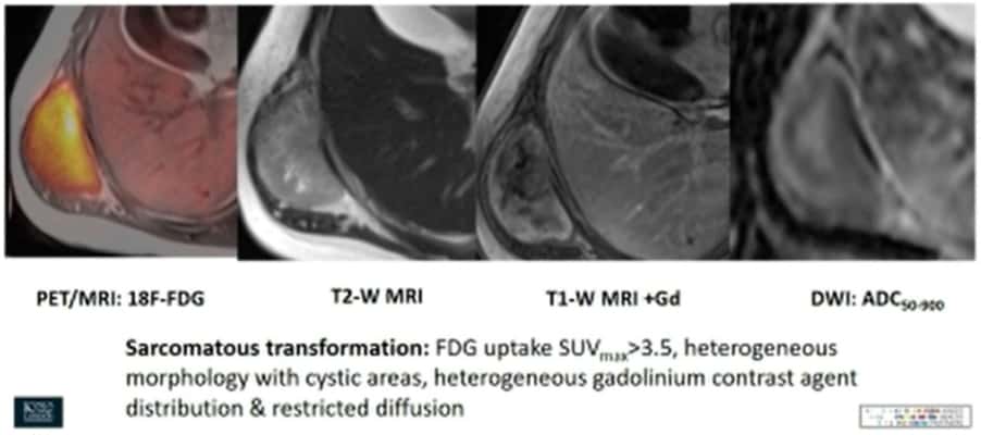 A Glimpse Into The Future World Of Hybrid Imaging – Physics World