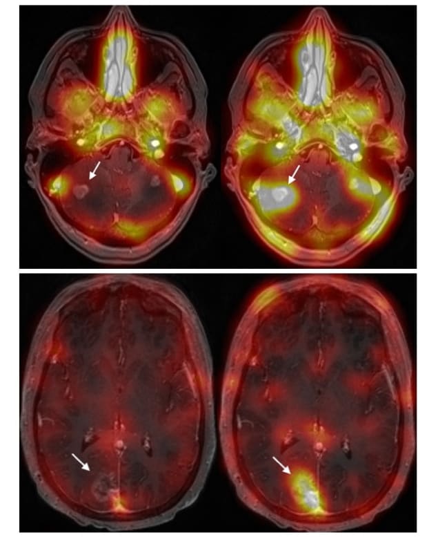 MR/SPECT images