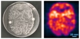 Direct positron emission imaging